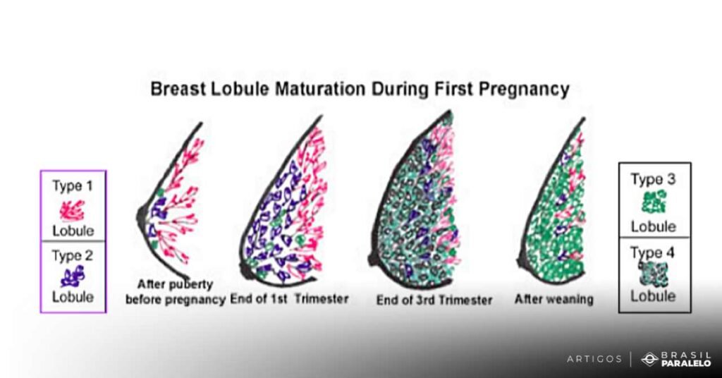 Cancer-de-mama-e-aborto