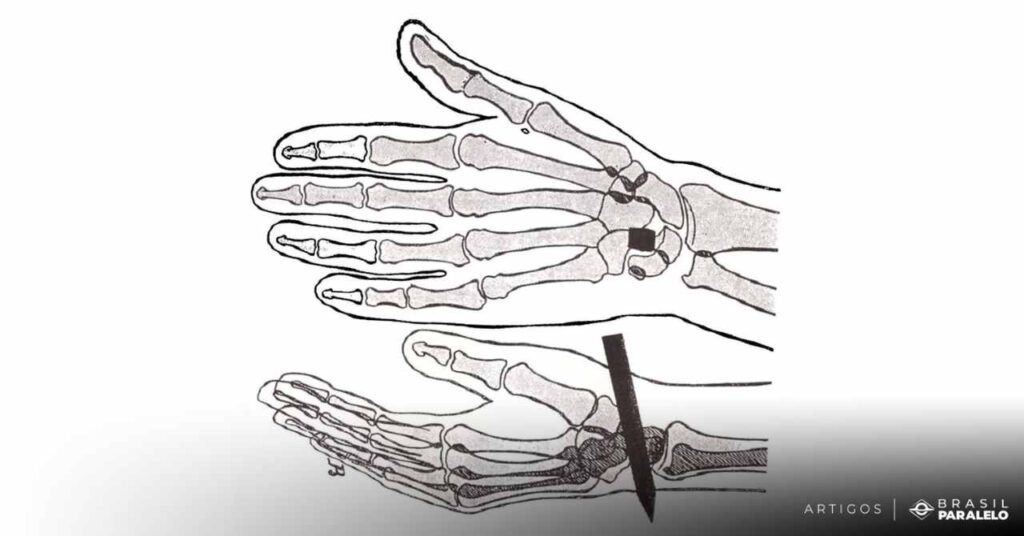 Fisiopatologia-da-crucificacao-de-Jesus