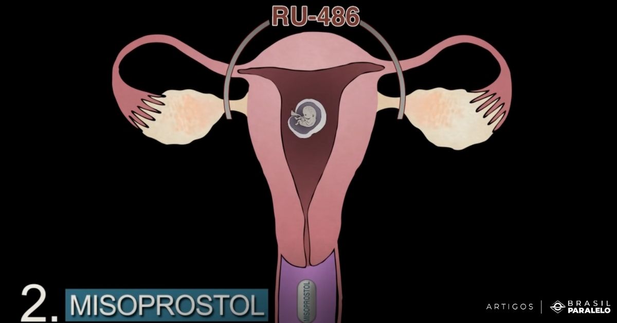 aborto-misoprostol
